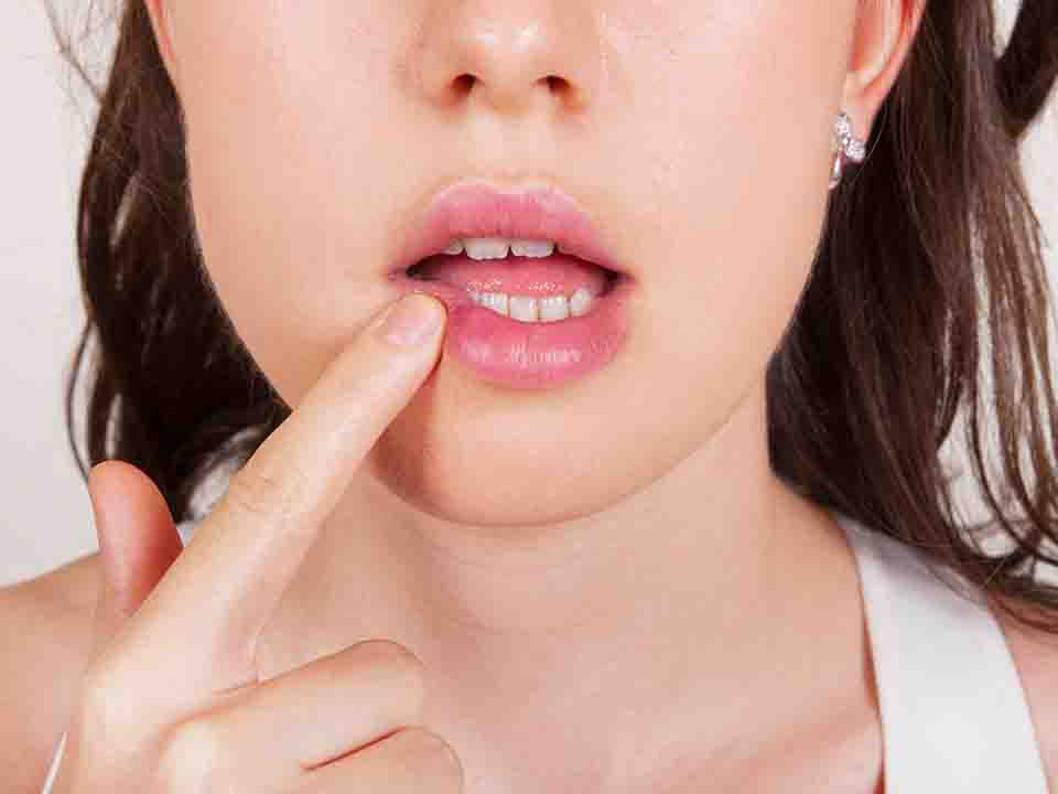 常用的口腔溃疡的治疗方法有哪些?