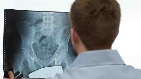 坐骨神经痛的原因