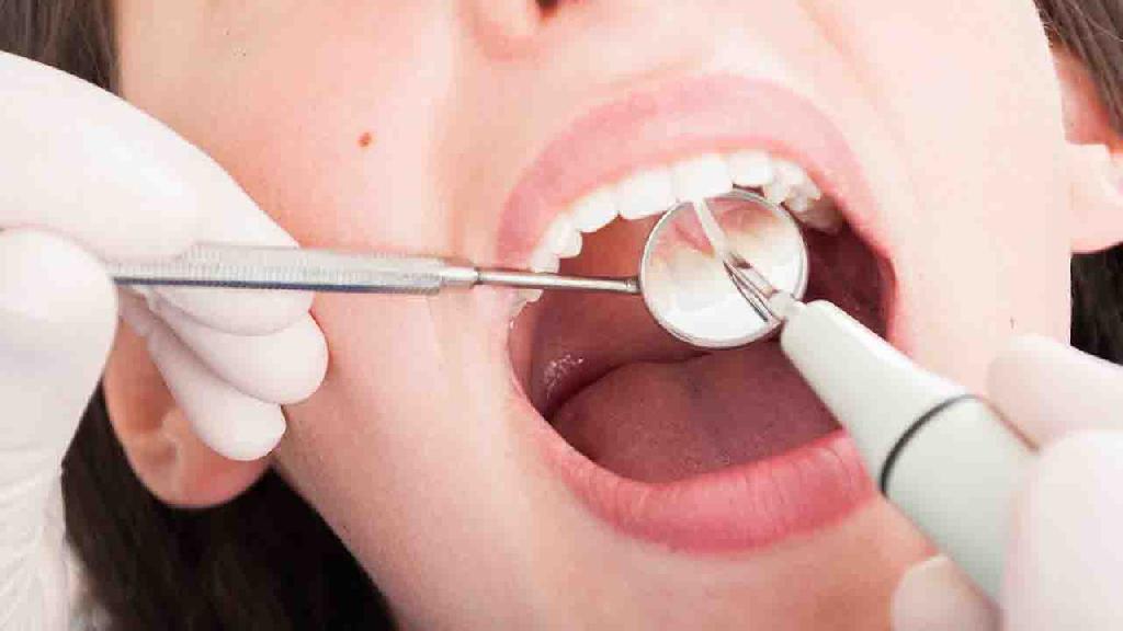 如何自我检查牙龈萎缩