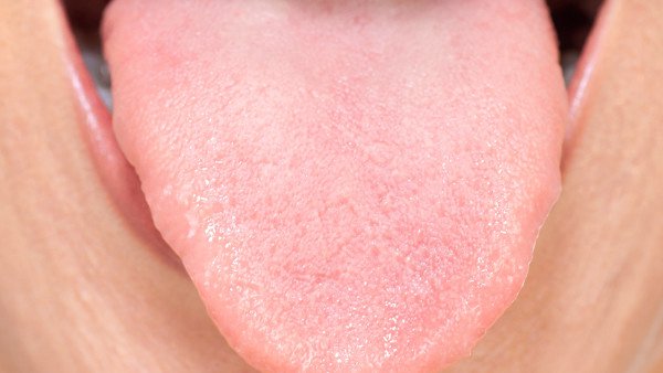 舌头痛要警惕舌癌 舌癌早期症状是怎样的？
