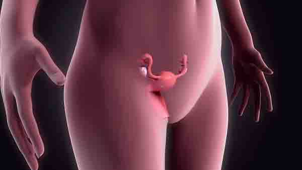子宫囊肿是在子宫里吗