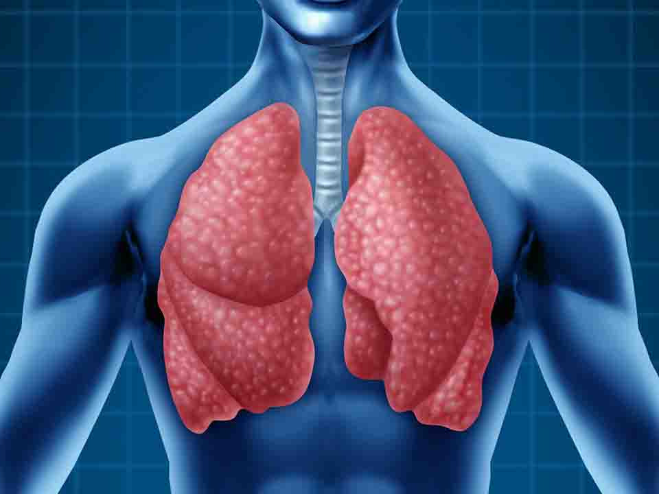 肺纤维化是什么意思