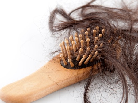 脱发怎么治疗效果好？ 如何治疗脱发更有效？