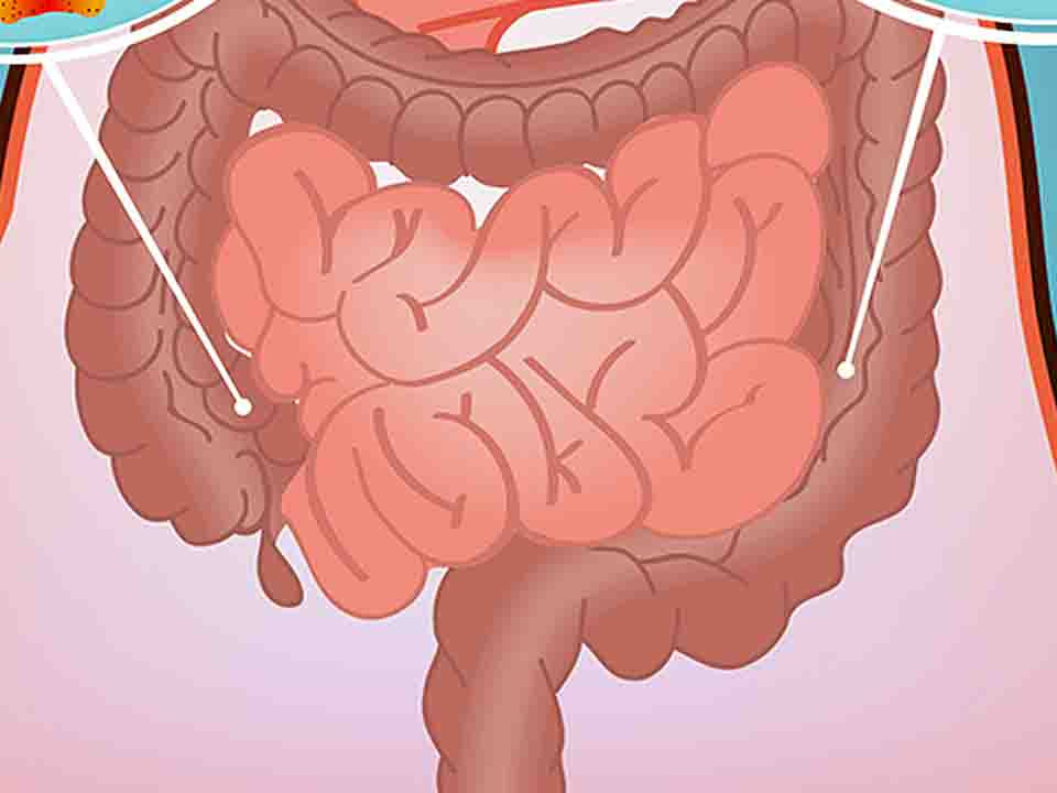 慢性腸炎的鑒別診斷