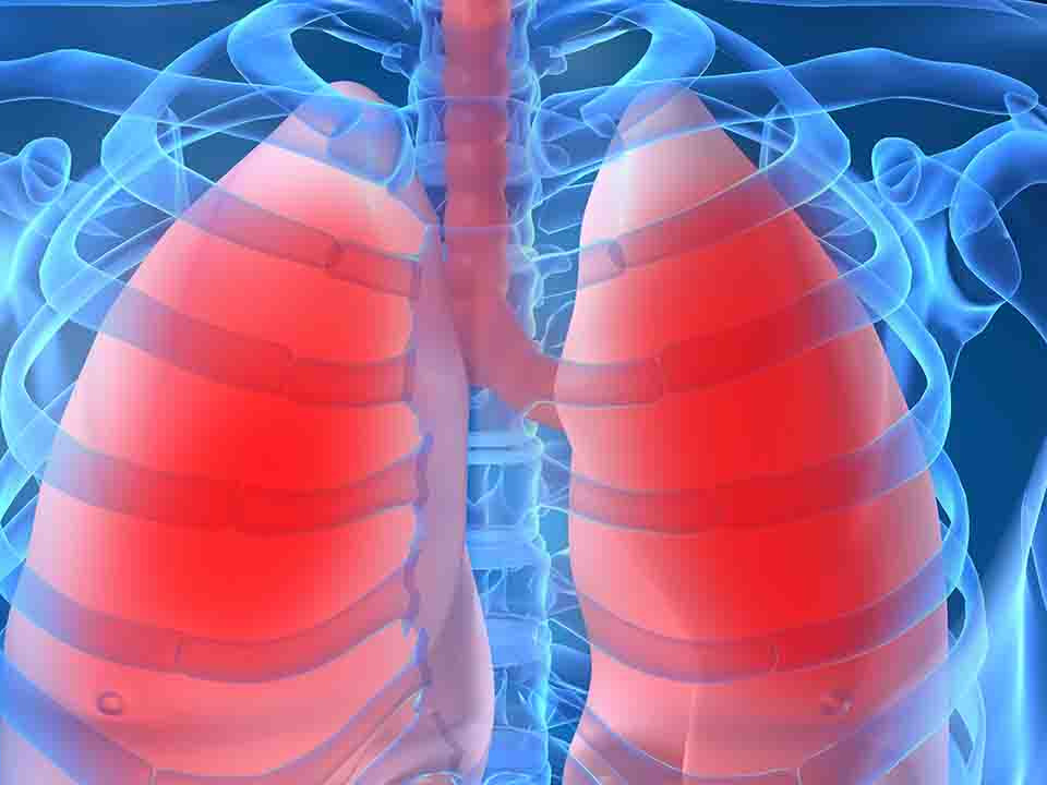 局限性肺气肿怎么治疗