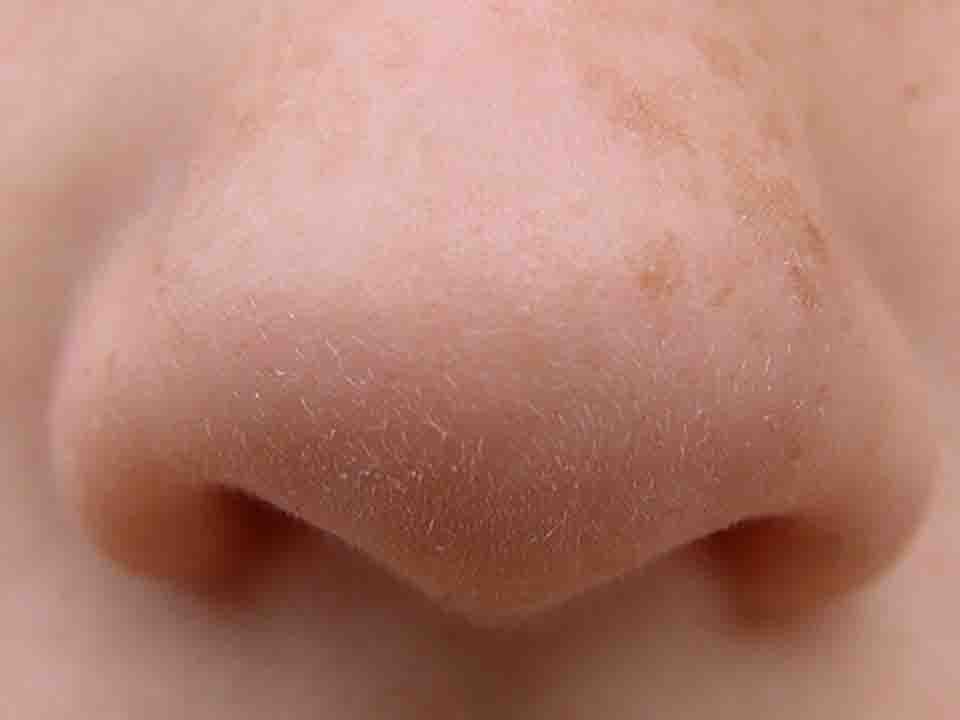 鼻咽癌4期的存活期