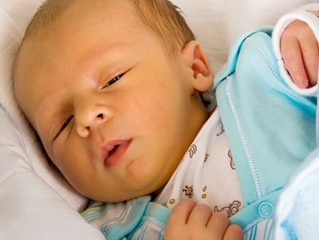 新生儿黄疸准妈妈别心急，5项关键措施要谨记
