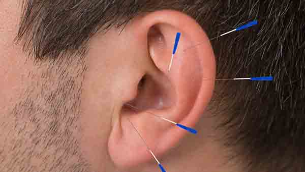 哪些原因导致人们患上耳石症