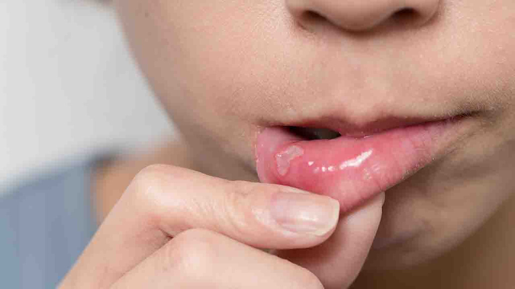 唇炎的主要危害是什么