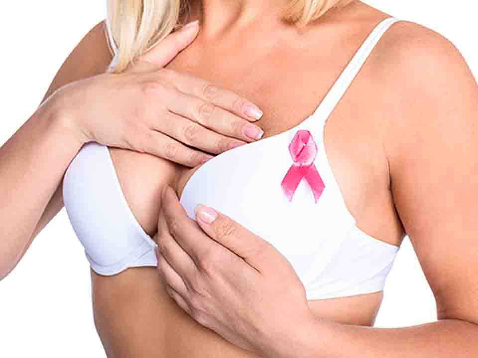 乳腺癌三期四期会死吗