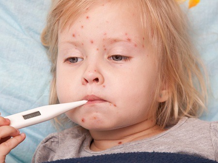 湿疹的治疗方法有哪些？正确认识湿疹治疗