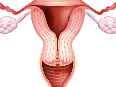 子宫内膜异位是怎么造成的？3大原因来了解