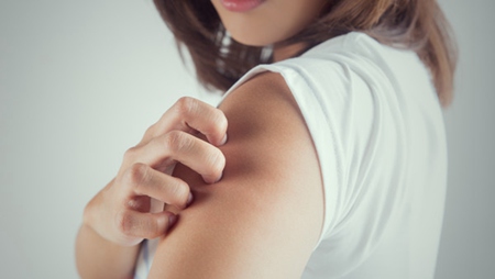 常见的荨麻疹过敏原有哪些？5个因素逐一讲解