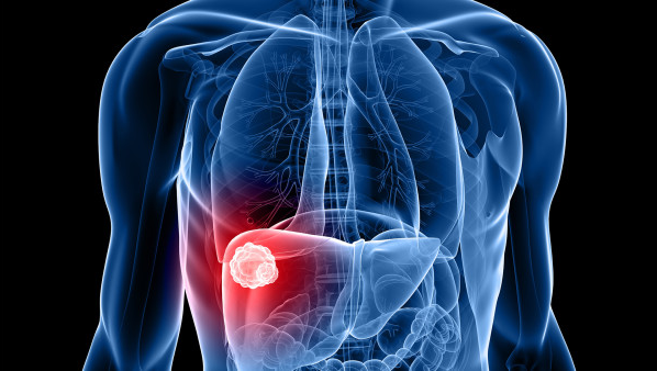 肝区刺痛是什么原因 肝区刺痛可能是6种疾病预警