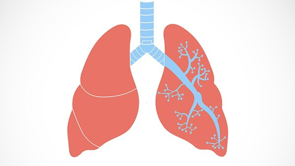 肺炎反复发作怎么回事，如何防止肺炎复发？