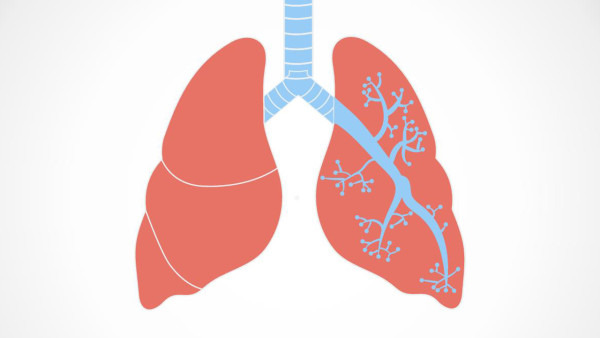 肺炎是由什么引起的？可能是这6个原因造成的