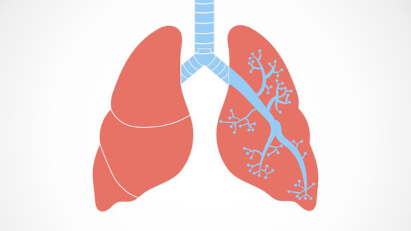 肺纹理是什么意思，肺纹理增粗的种类有哪些？