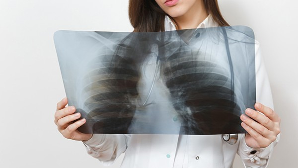 肺结核是如何进行确诊的 肺结核常见的检查方法都有哪些