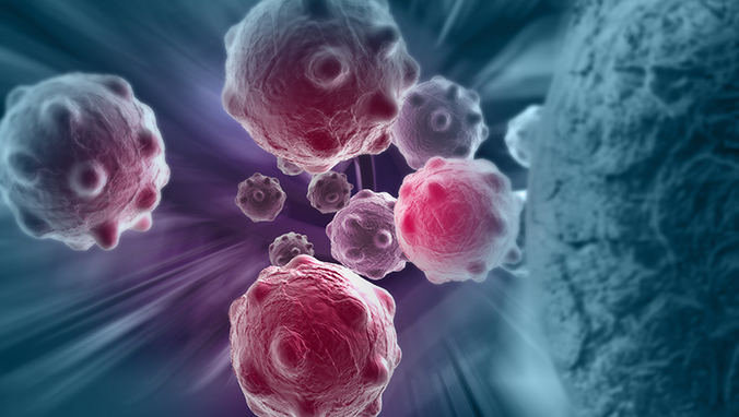 多发性骨髓瘤容易出现各种细菌性感染 常见的化疗方案是什么