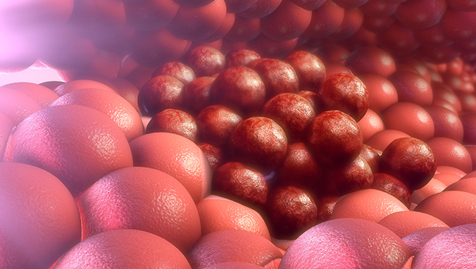 淋巴细胞瘤是什么病 淋巴细胞瘤都有哪些分型