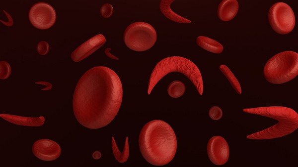 败血症是血癌吗 败血症的病因是什么