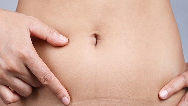 肚脐眼流水是怎么回事