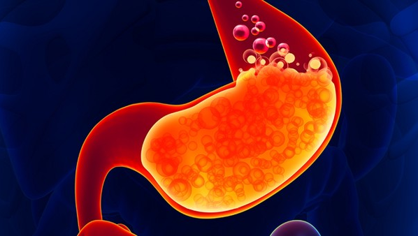 胃出血是怎么回事 常见的病因有3种