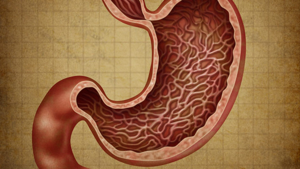 什么是糜烂性胃窦炎 糜烂性胃窦炎会传染吗
