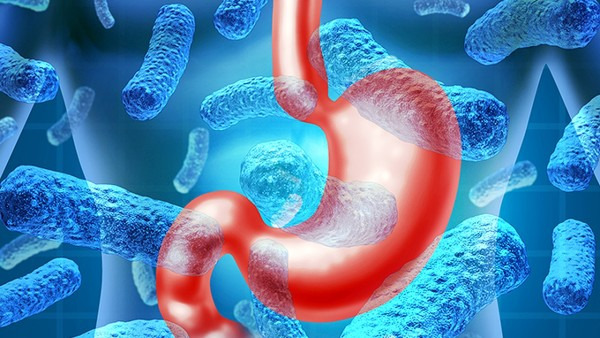 慢性浅表性胃炎是怎么回事 引发慢性浅表性胃炎的5个原因