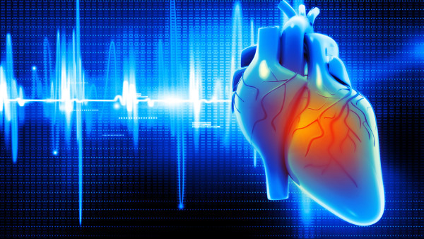 心肌梗死心电图能看出来吗 心肌梗死的心电图特征是什么