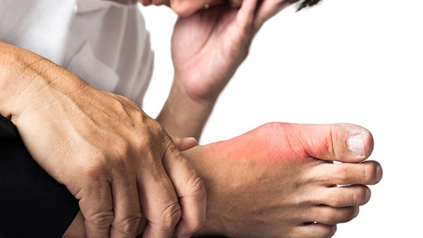大脚趾疼是痛风吗 痛风的症状表现都有哪些