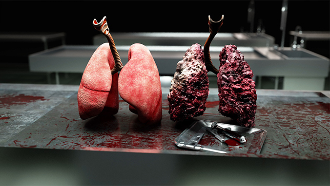 肺癌肾上腺转移生存率