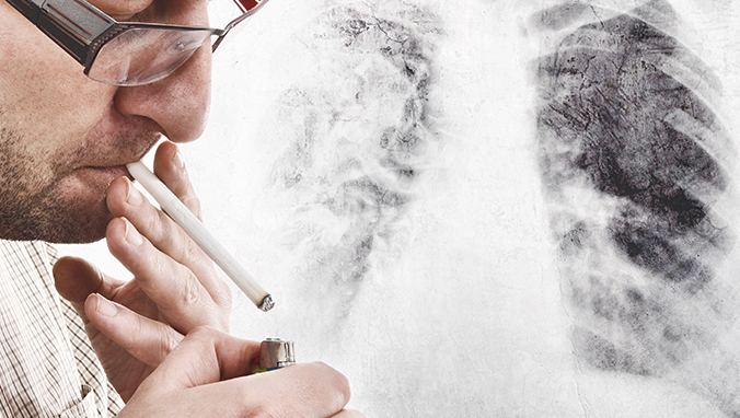 肺癌和上腔静脉综合症有什么关系