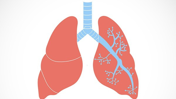 引起肺癌的原因有哪些？注意这五个方面
