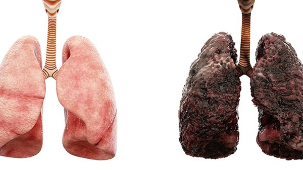 青少年吸烟有什么危害？会影响这四个方面