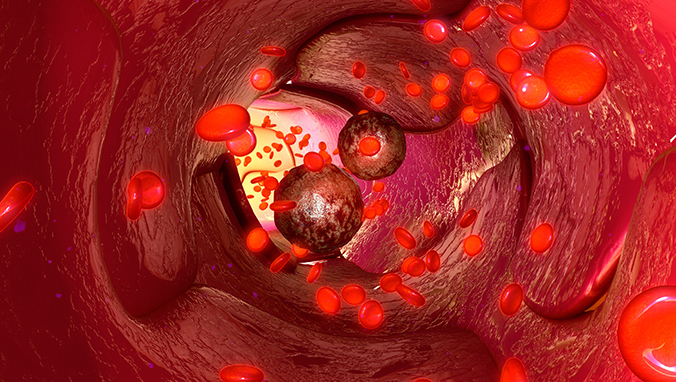 胃癌后背疼痛在哪