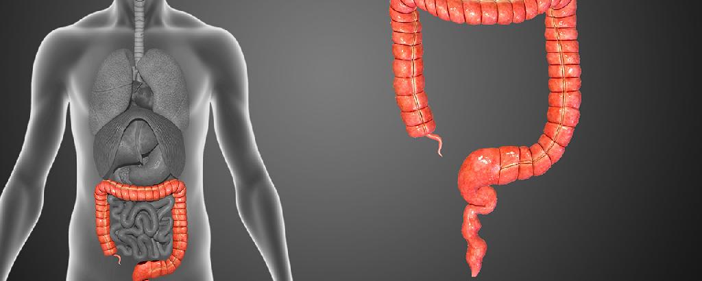 经常放屁是肠癌吗