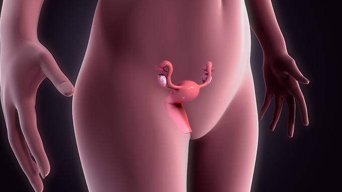 卵巢癌的早期症状 早期卵巢癌常见的4个症状