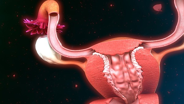 卵巢癌的早期症状表现 卵巢癌会导致绝经吗