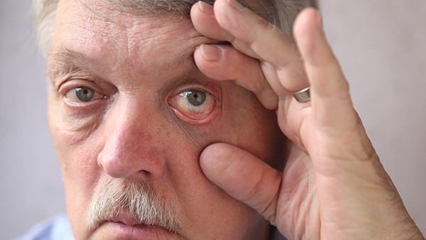 黄斑病变能不能治愈