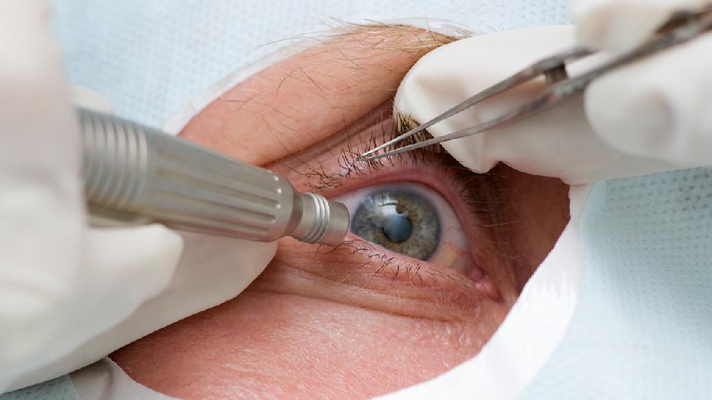 视网膜色素变性的治疗措施 视网膜色素变性的2个检查方法