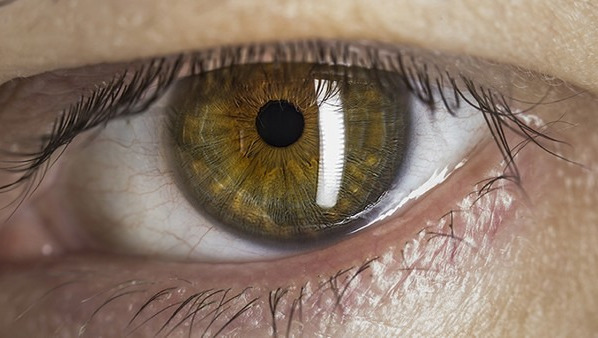 眼睛出现玻璃体混浊的原因 眼睛出现玻璃体混浊的3个因素