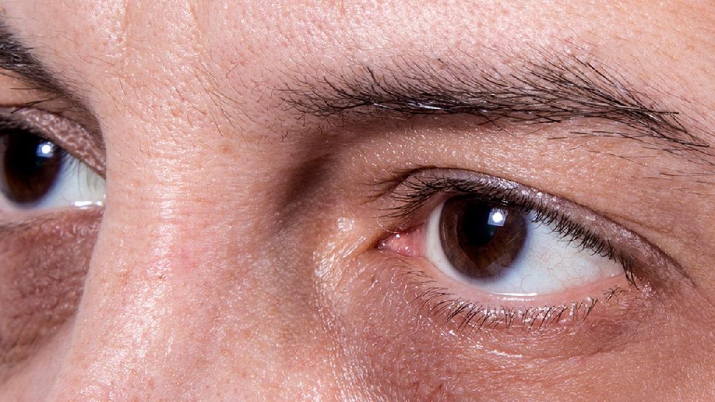 干眼病怎么来的 干眼病的危害都有哪些