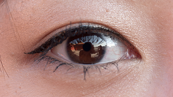 有黑眼圈怎么消除 黑眼圈怎么进行治疗