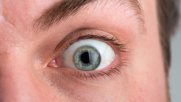 为什么白眼球上有黑斑 白眼球上有黑斑是什么原因导致的