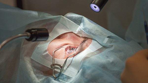 近视激光手术大概花费多少钱 近视手术的价格和这3个因素有关