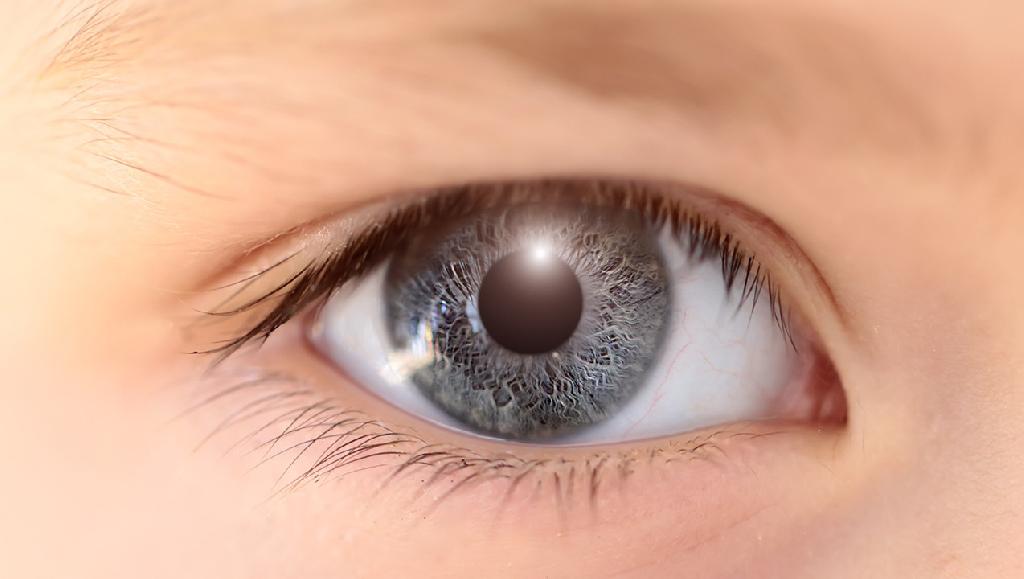 红眼病的初期症状都有哪些 红眼病会引发打喷嚏咳嗽吗