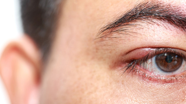 弱视主要的治疗方法都有哪些 治疗弱视使用单眼遮盖疗法有用吗