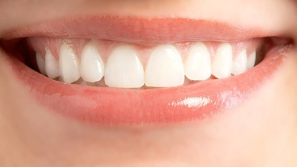牙结石能自己抠掉吗 牙结石的常见病因