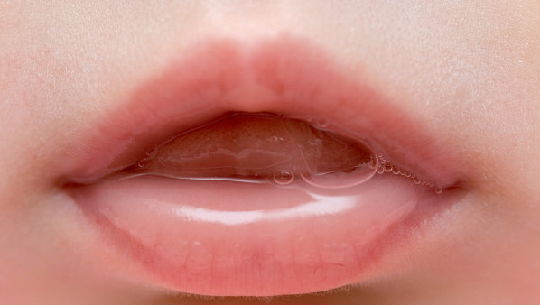小孩抵抗力差 嘴唇容易干裂 教你4个治疗方法